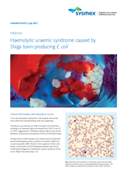 Haemolytic uraemic syndrome caused by Shiga toxin-producing E. coli