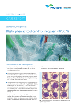 Blastic plasmacytoid dendritic neoplasm (BPDCN)
