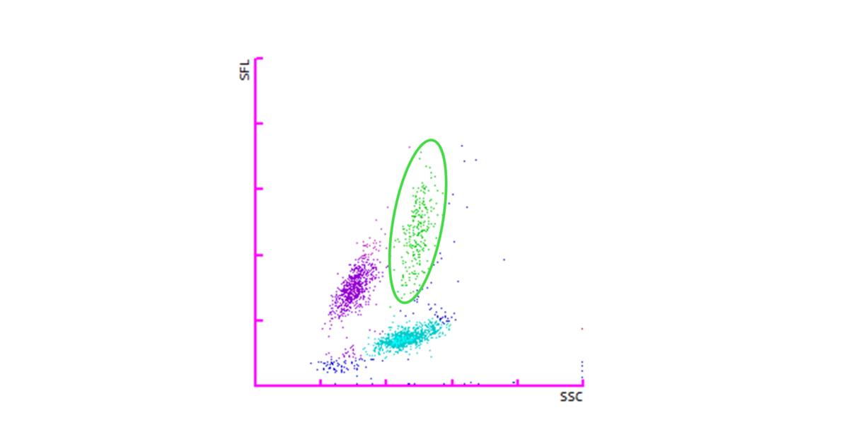 Fig. 3 WDF scattergram showing a slight upward trend of the monocyte cloud (green circle).