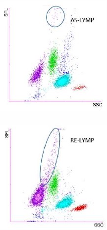 [.DK-dk Denmark (danish)] Scattergram AS-Lymp RE-Lymp