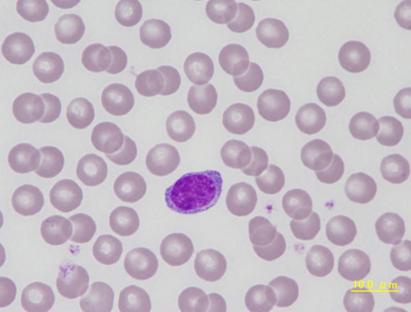 Canine atypical lymphocyte
