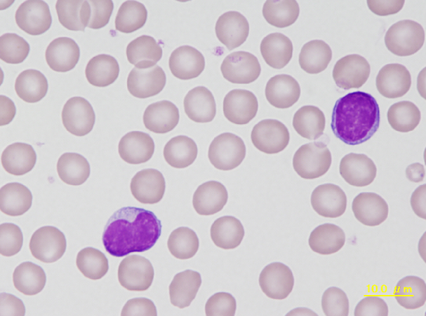 Guinea pig lymphocytes