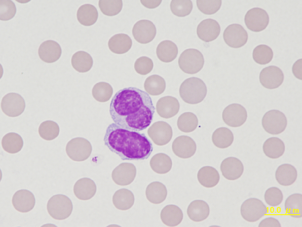 Rabbit lymphocytes