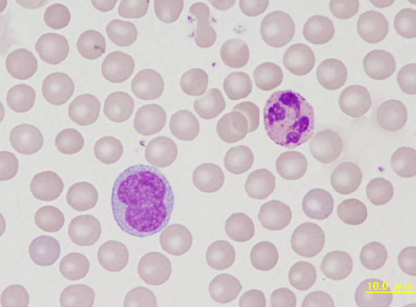 Rabbit monocyte and segmented heterophil