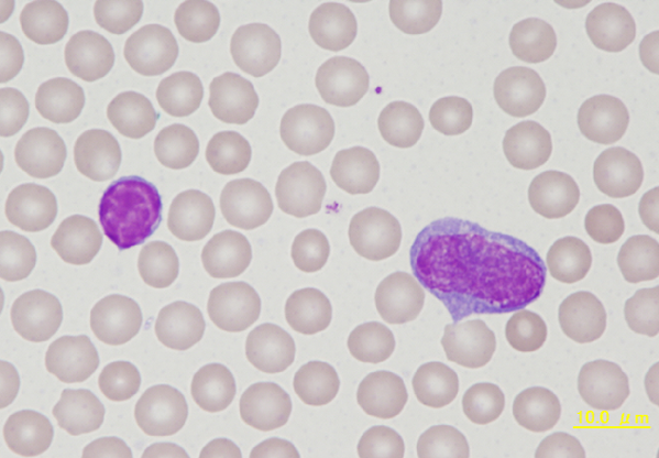 Rabbit small and atypical lymphocyte